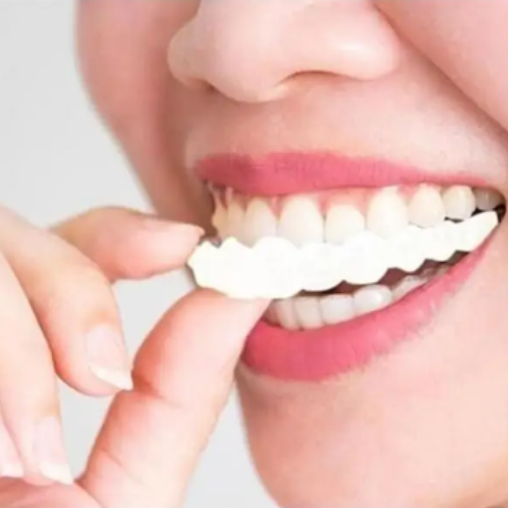Carillas dentales ajustables - Snapon Smile